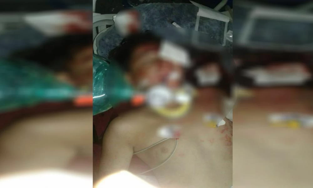 Αφρίν: Τούρκοι χτύπησαν με θωρακισμένο όχημα και εγκατέλειψαν δύο παιδιά